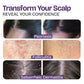 Psoriasis Shampoo for Dry & Itchy Scalp