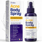 Body Acne Spray with 2% Salicylic Acid & Tea Tree Oil