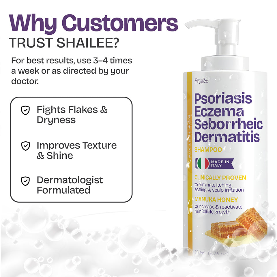 Psoriasis Shampoo for Dry & Itchy Scalp