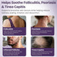 Folliculitis Cream for Scalp, Face & Body