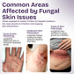 Antifungal Tea Tree Body Wash for Eczema, Jock Itch & Back Acne