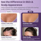 Folliculitis Cream for Scalp, Face & Body