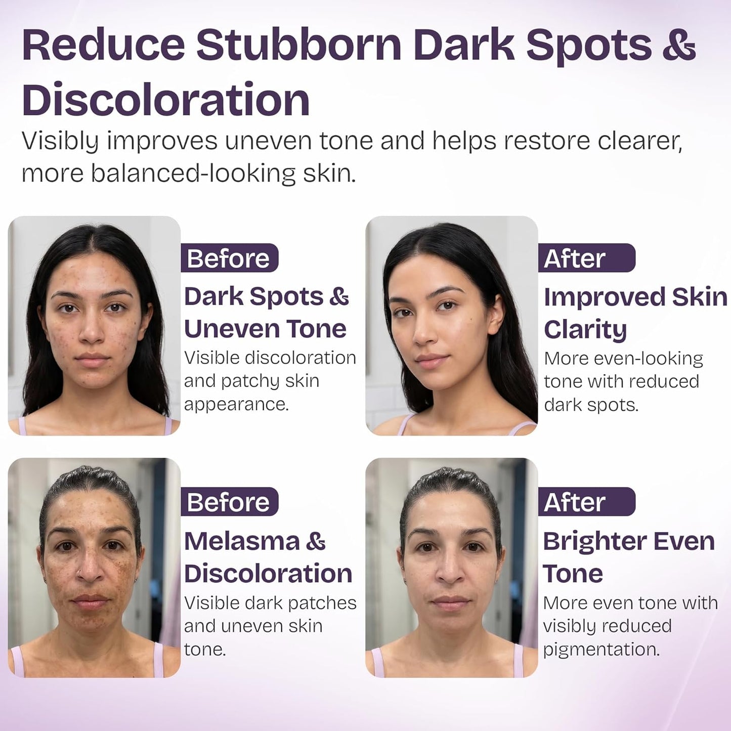 Dark Spot Correcting Serum with 10% Niacinamide