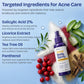 Body Acne Spray with 2% Salicylic Acid & Tea Tree Oil
