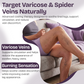 Varicose Veins Cream for Legs & Spider Veins
