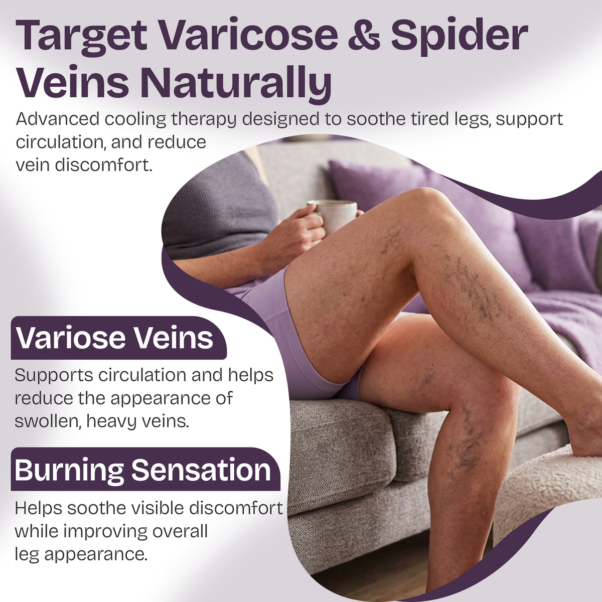 Varicose Veins Cream for Legs & Spider Veins