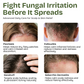 Antifungal Tea Tree Shampoo with Scrubber