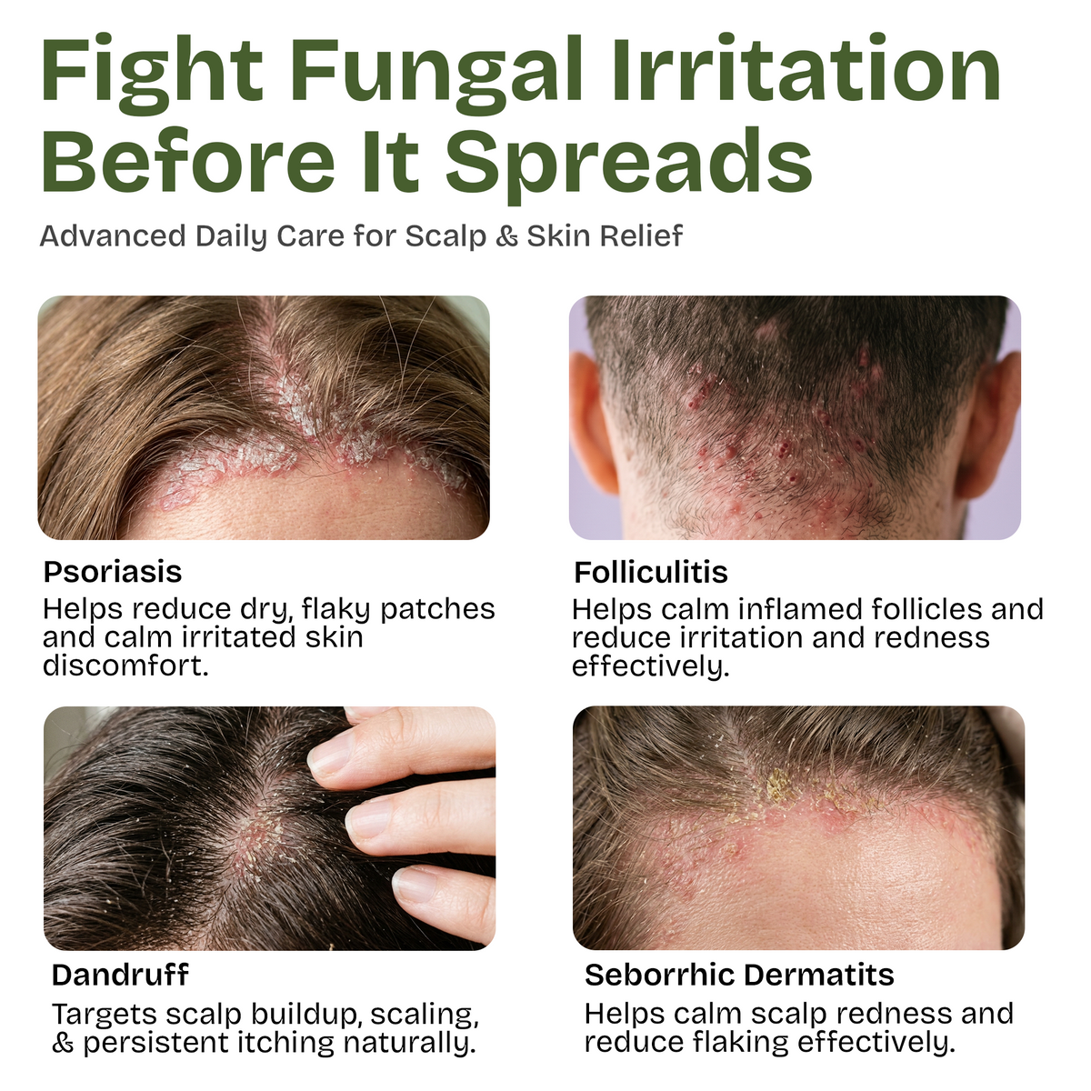 Antifungal Tea Tree Shampoo with Scrubber