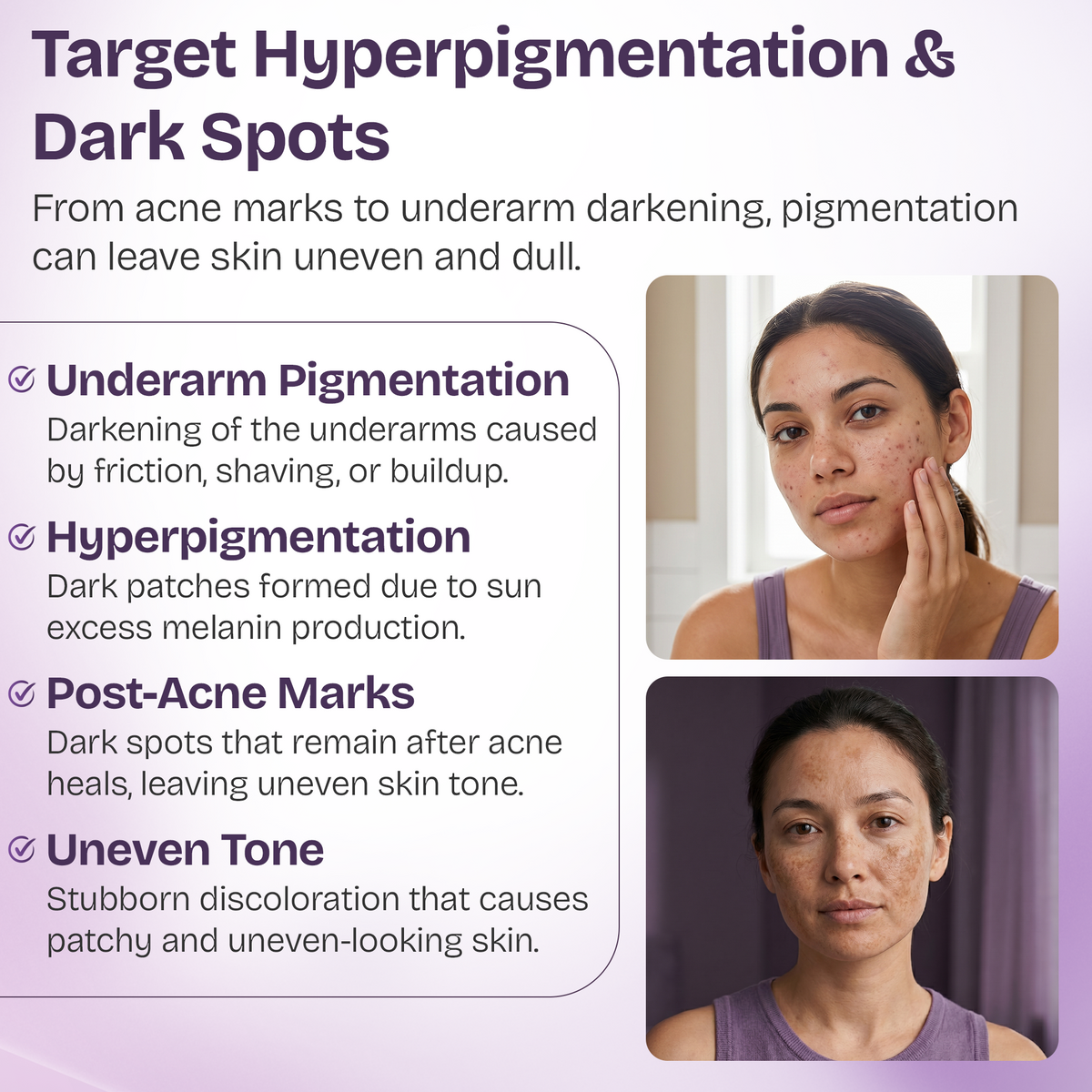 Dark Spot Correcting Serum with 10% Niacinamide