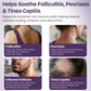 Folliculitis Cream with 2% Miconazole Nitrate