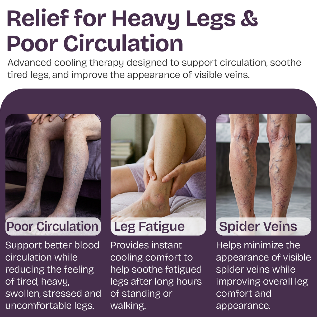 Varicose Veins Cream for Legs & Spider Veins