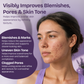 Azelaic Acid Face Serum for Uneven Skin Tone & Visible Redness