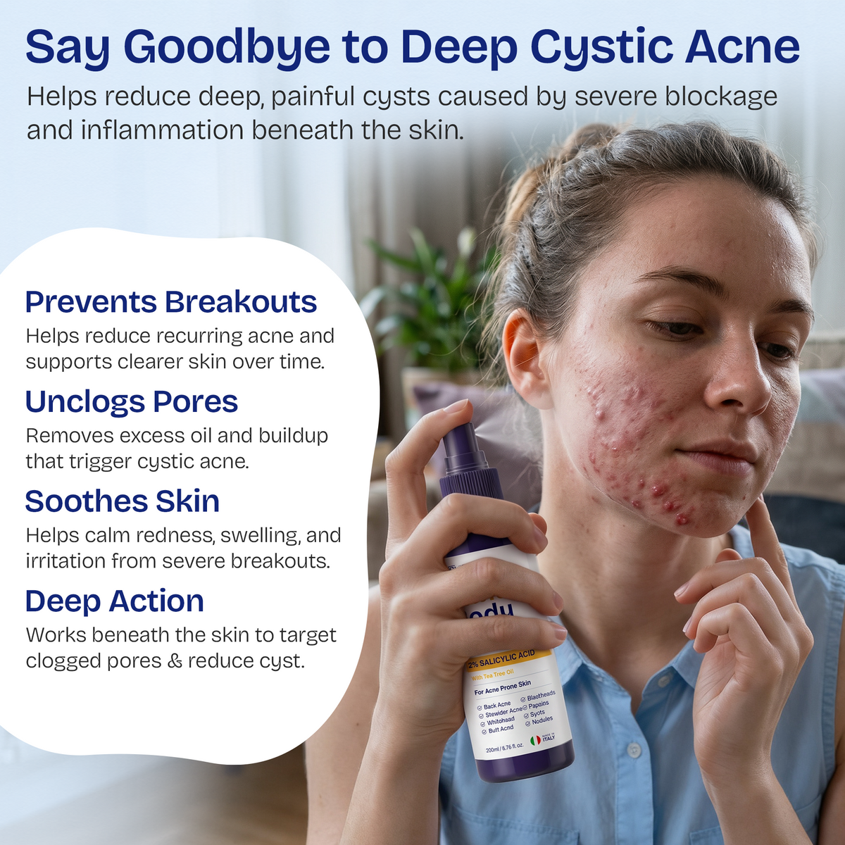 Body Acne Spray with 2% Salicylic Acid & Tea Tree Oil