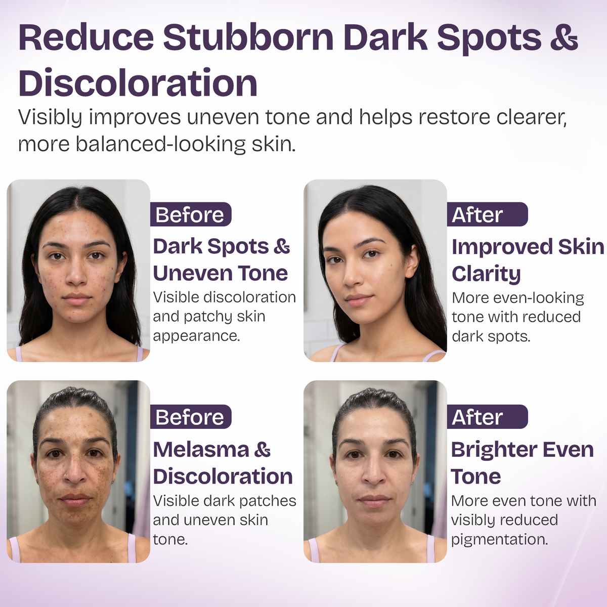 Dark Spot Correcting Serum with 10% Niacinamide