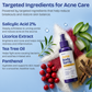 Body Acne Spray with 2% Salicylic Acid & Tea Tree Oil