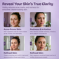 Azelaic Acid Face Serum for Uneven Skin Tone & Visible Redness